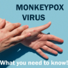 NYC Now EPICENTER of MONKEYPOX EPIDEMIC - What You Need To Know